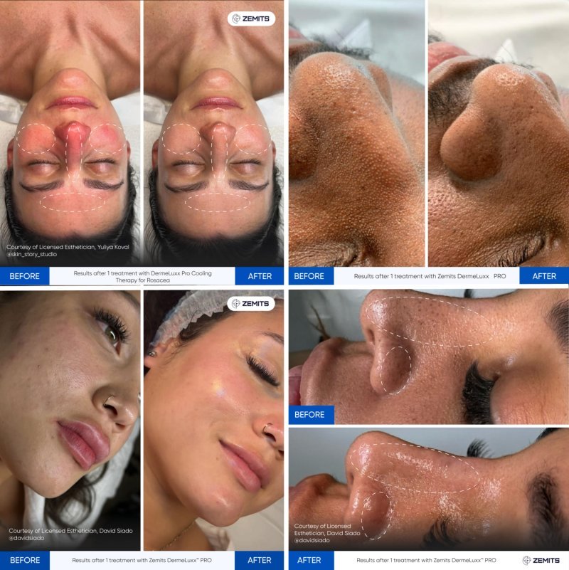 DermeLuxx.jpg My default image