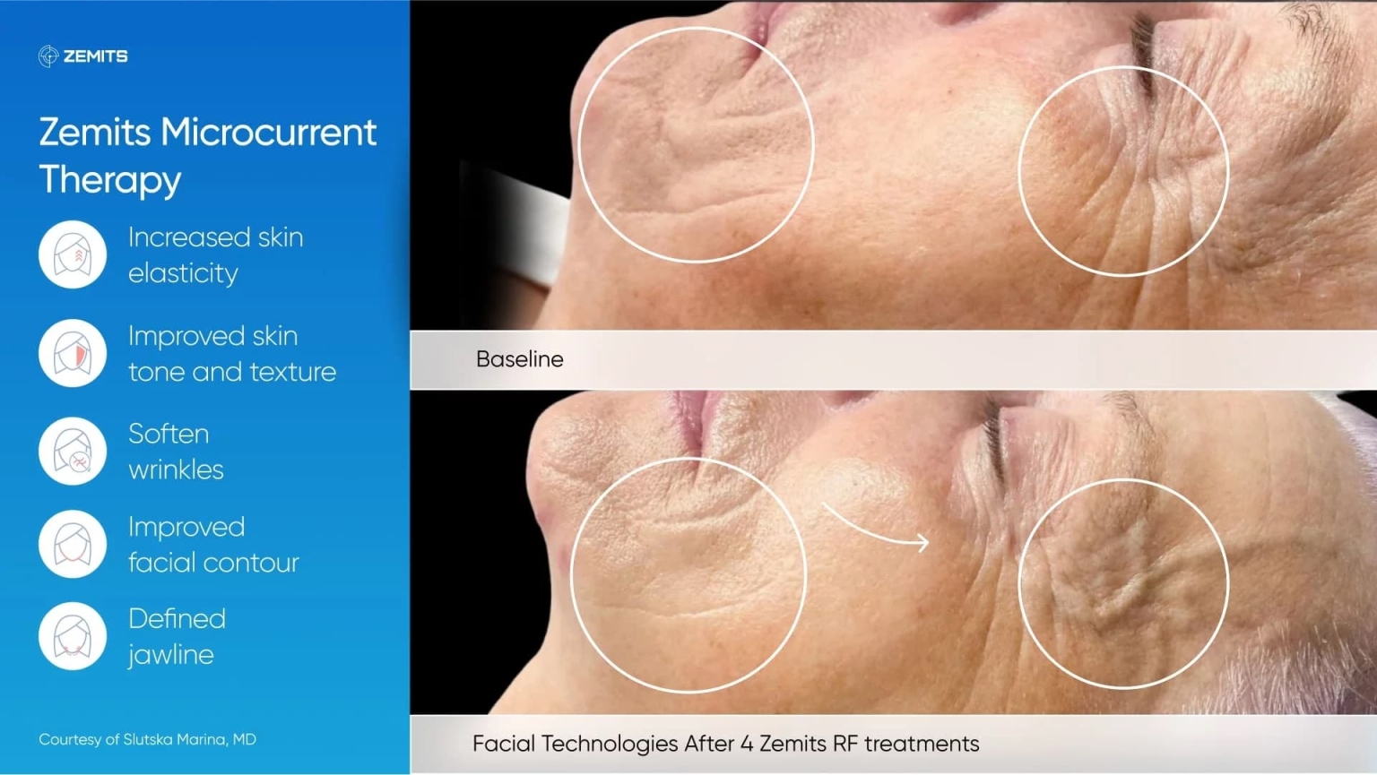 a-e-results-110 (1).jpg My default image