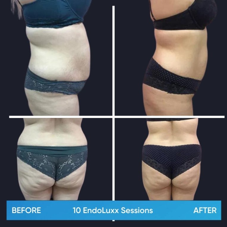 3.jpg My default image