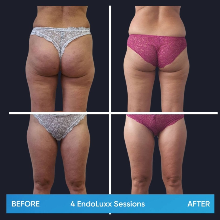 7.jpg My default image