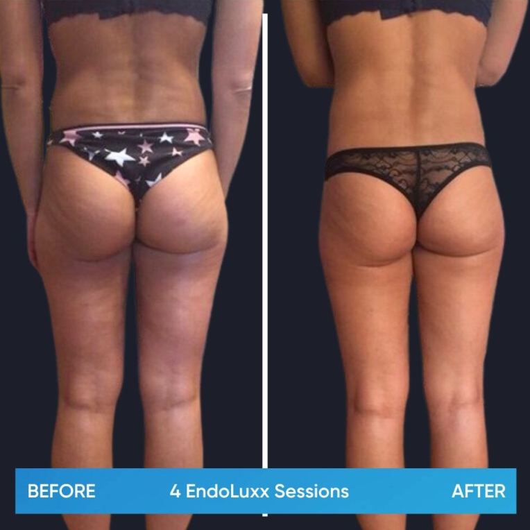 1.jpg My default image