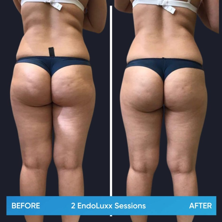 4.jpg My default image