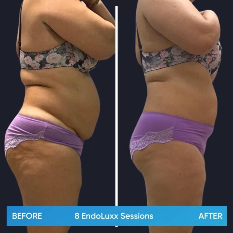 8.jpg My default image