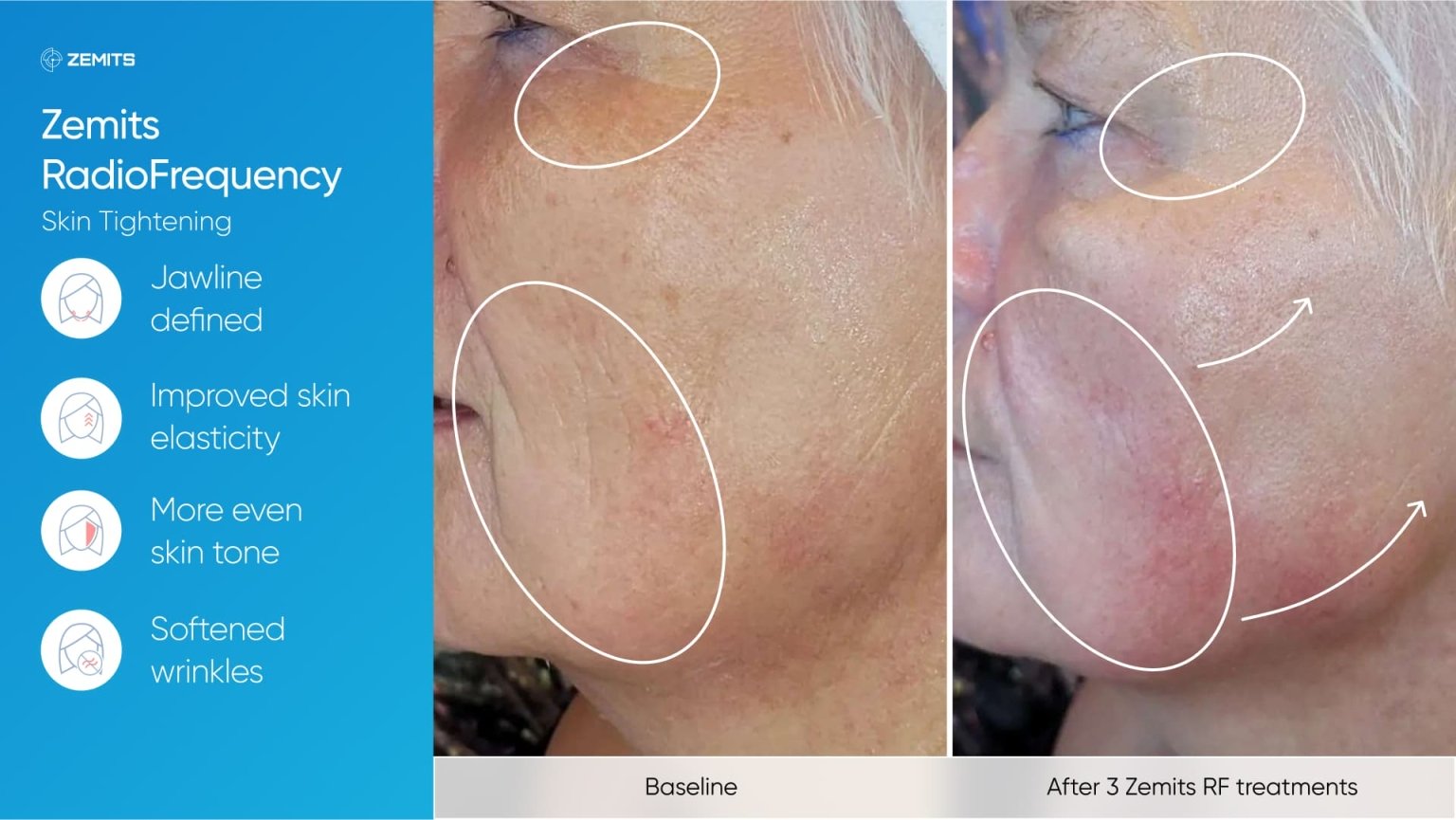 Zemits_real_results_010.jpg My default image