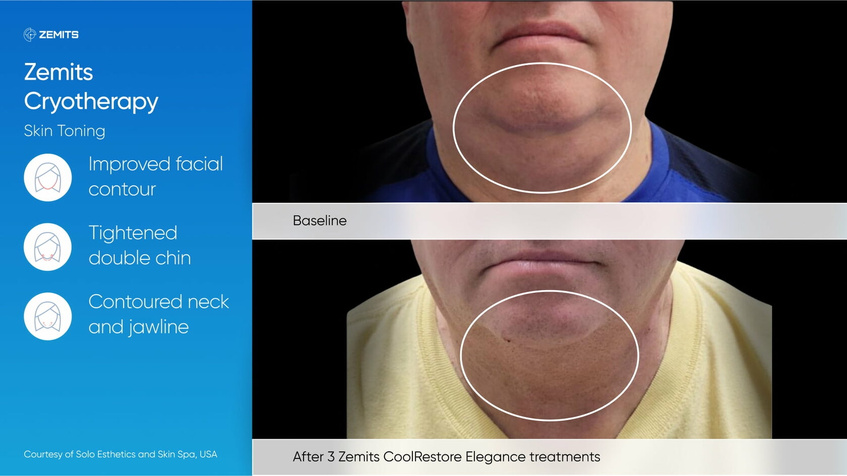 Zemits_real_results_102.jpg My default image