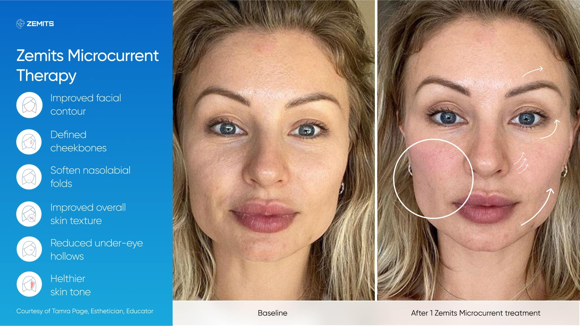 Zemits_real_results_201.jpg My default image