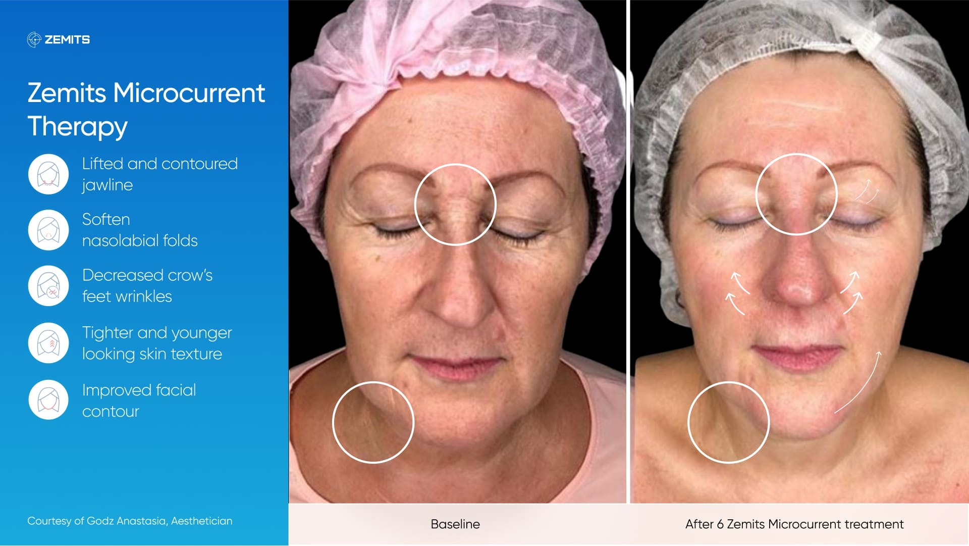 Zemits_real_results_203.jpg My default image