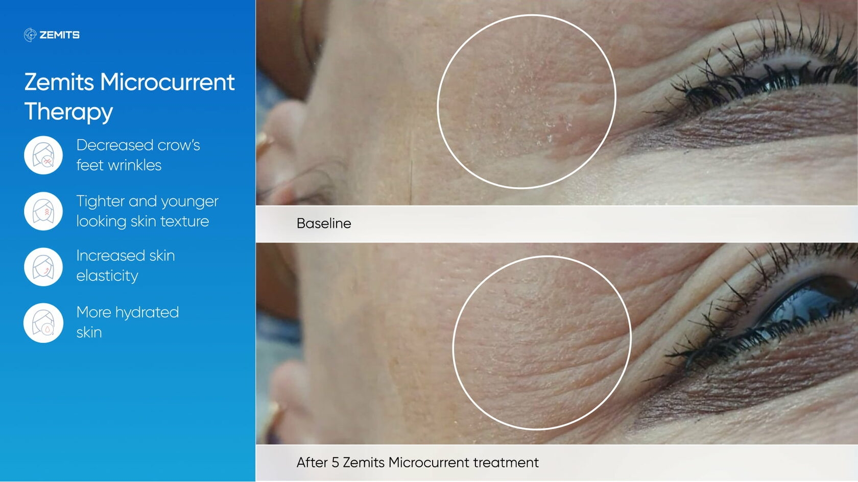 Zemits_real_results_204.jpg My default image