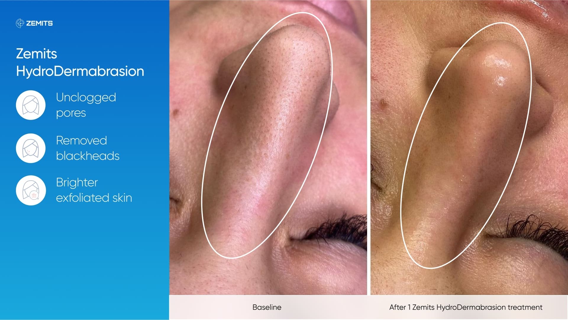 Zemits_real_results_301.jpg My default image