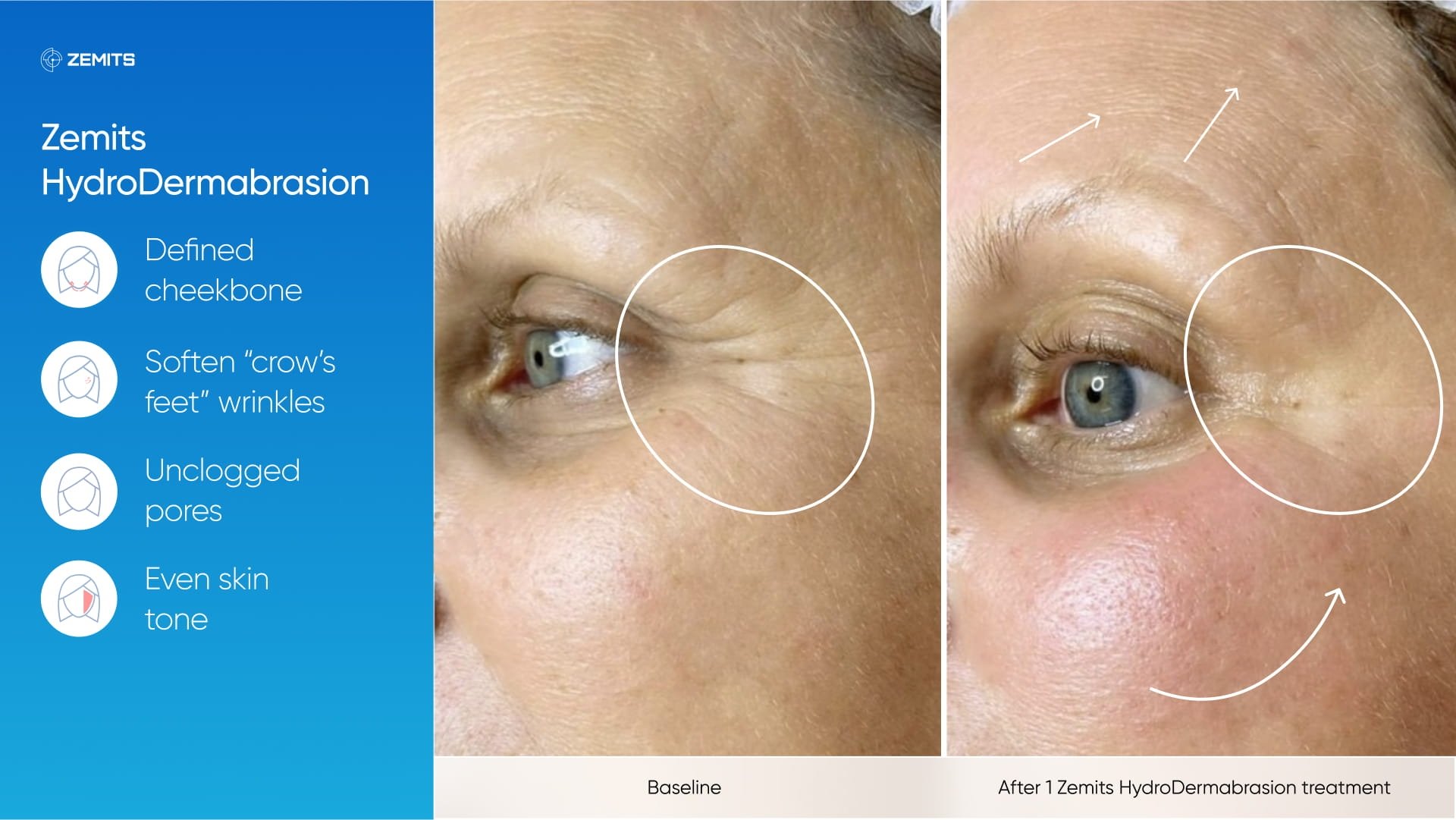 Zemits_real_results_303.jpg My default image