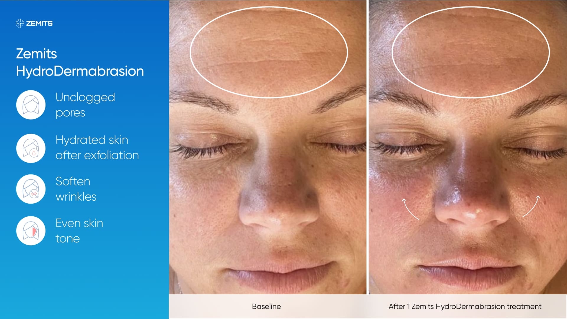 Zemits_real_results_304.jpg My default image