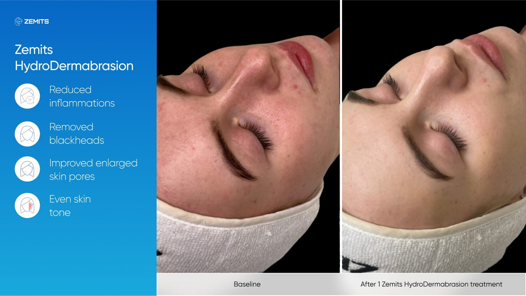 Zemits_real_results_305.jpg My default image