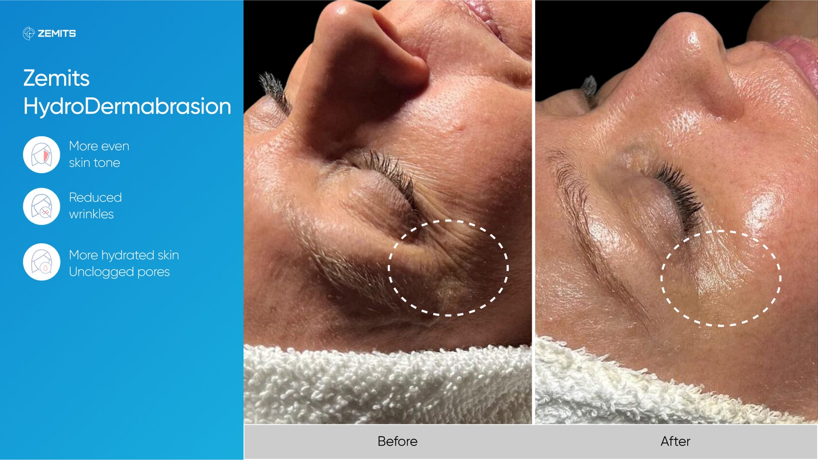 Zemits_real_results_306.jpg My default image