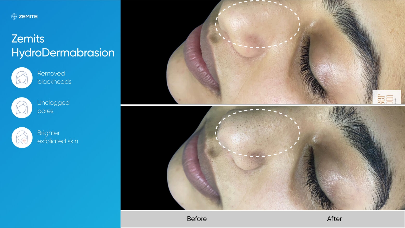 Zemits_real_results_307.jpg My default image