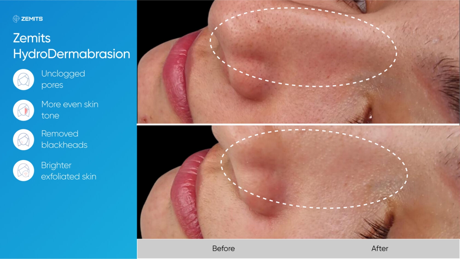 Zemits_real_results_308.jpg My default image