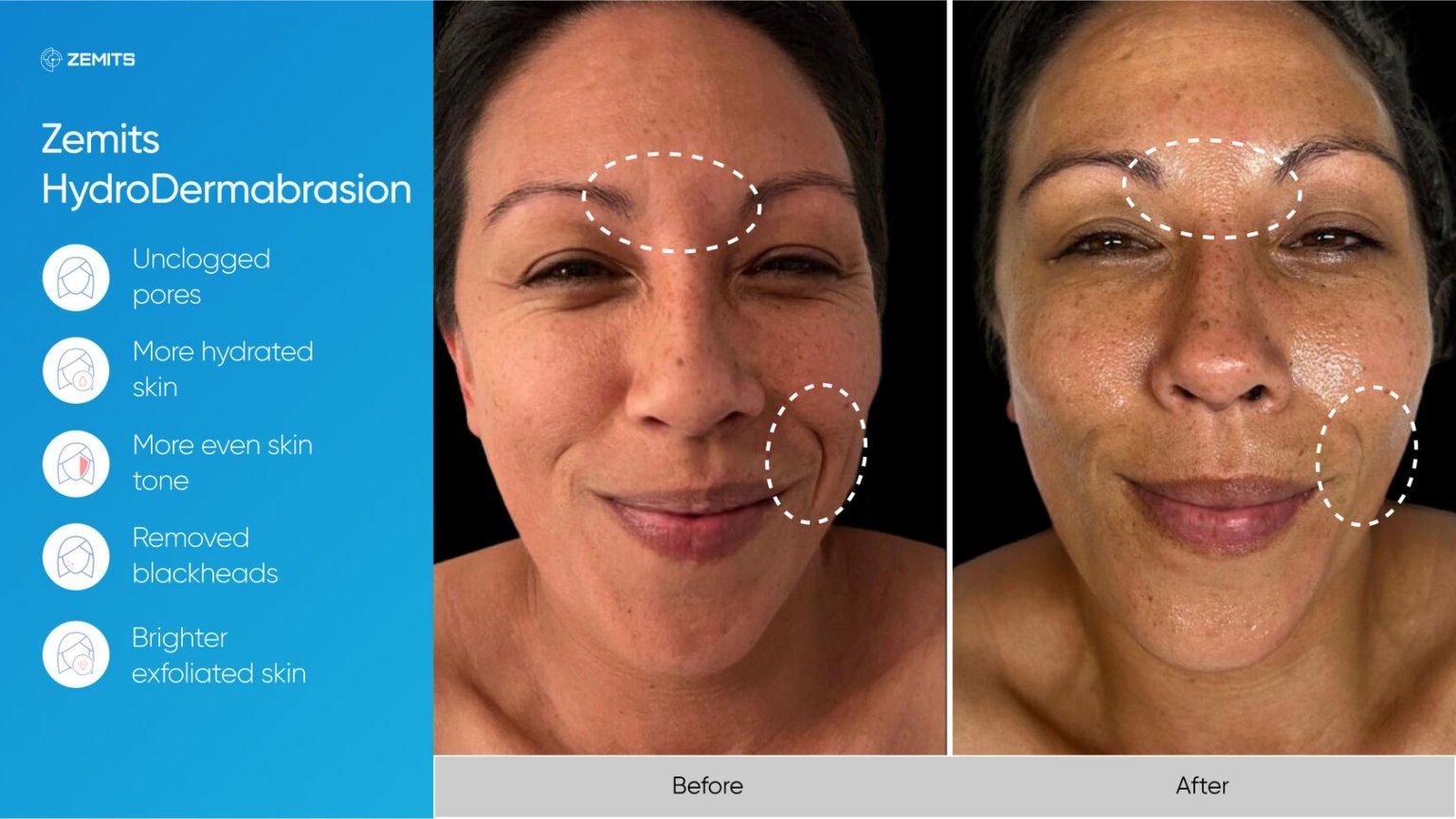 Zemits_real_results_309.jpg My default image