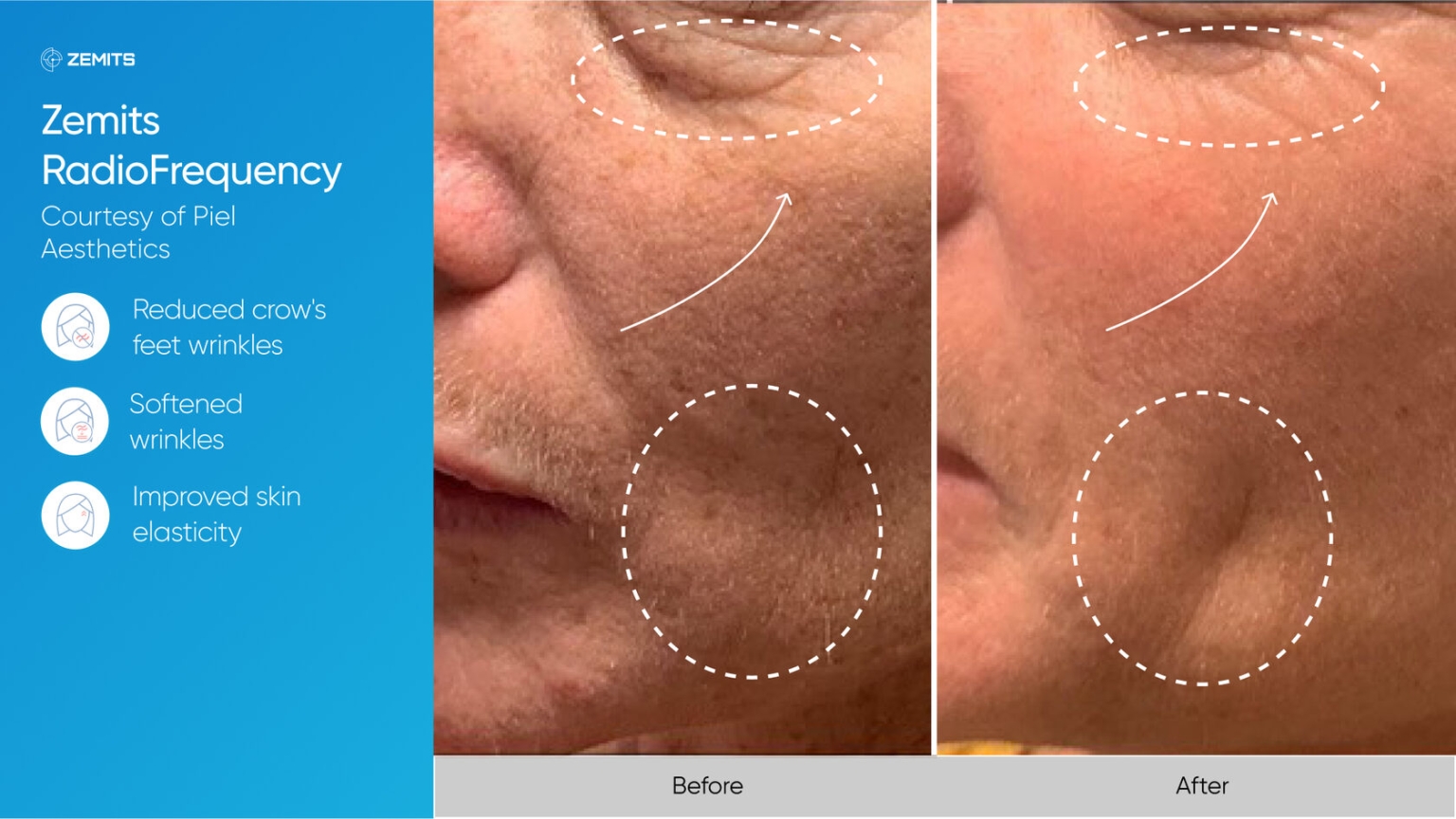 Zemits_real_results_310.jpg My default image