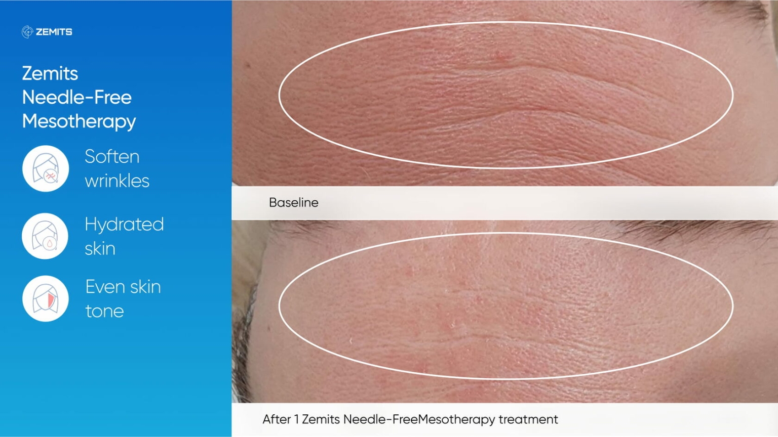 Zemits_real_results_401.jpg My default image