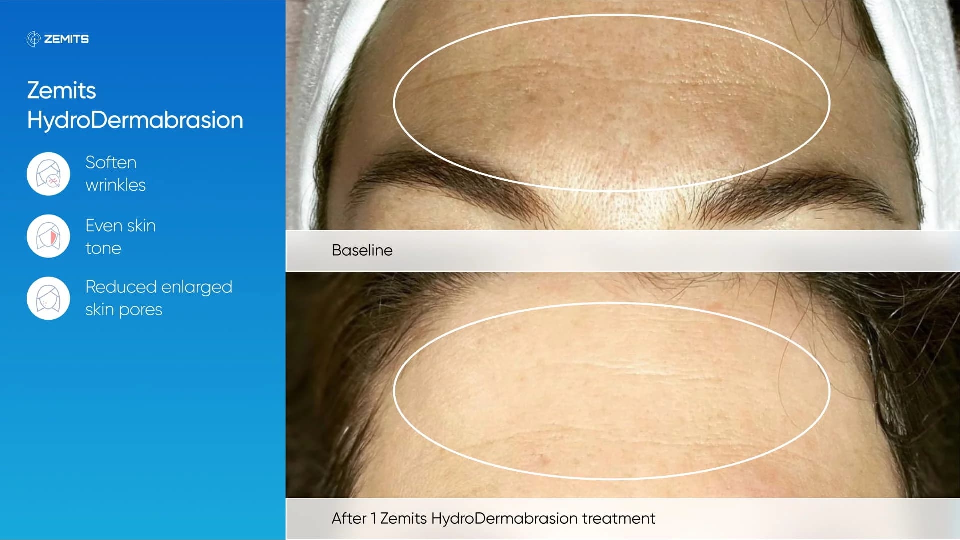 Zemits_real_results_302 (1).jpg My default image