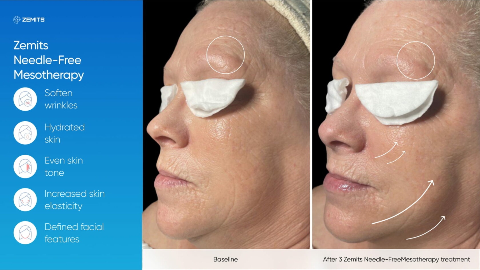 Zemits_real_results_402.jpg My default image