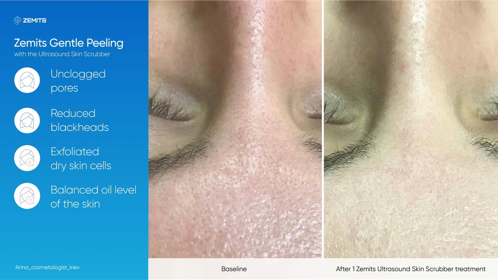 Zemits_real_results_501.jpg My default image