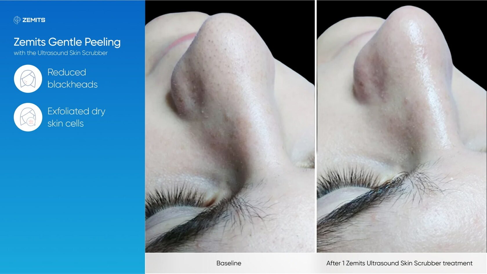 Zemits_real_results_502.jpg My default image