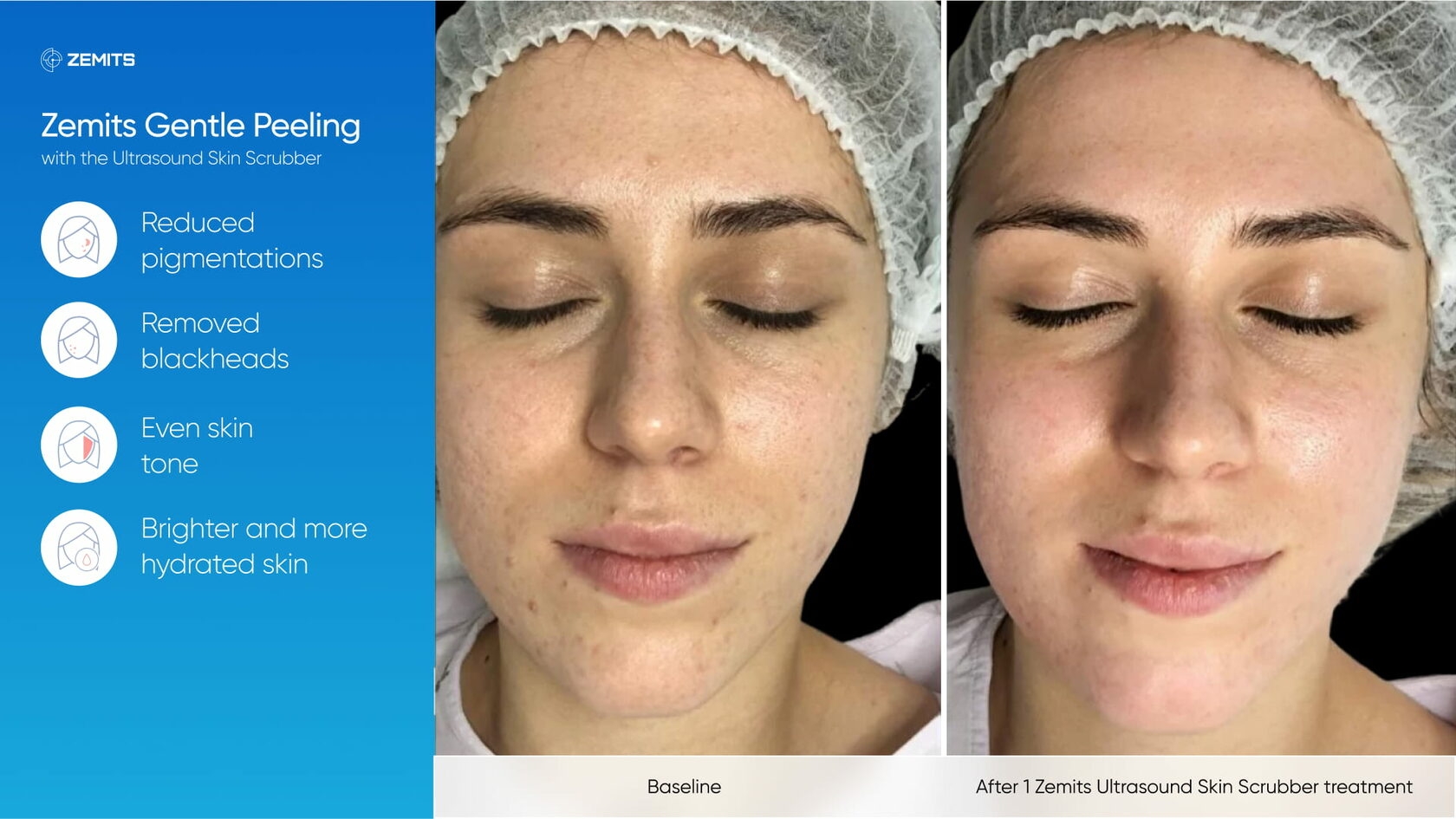 Zemits_real_results_503.jpg My default image