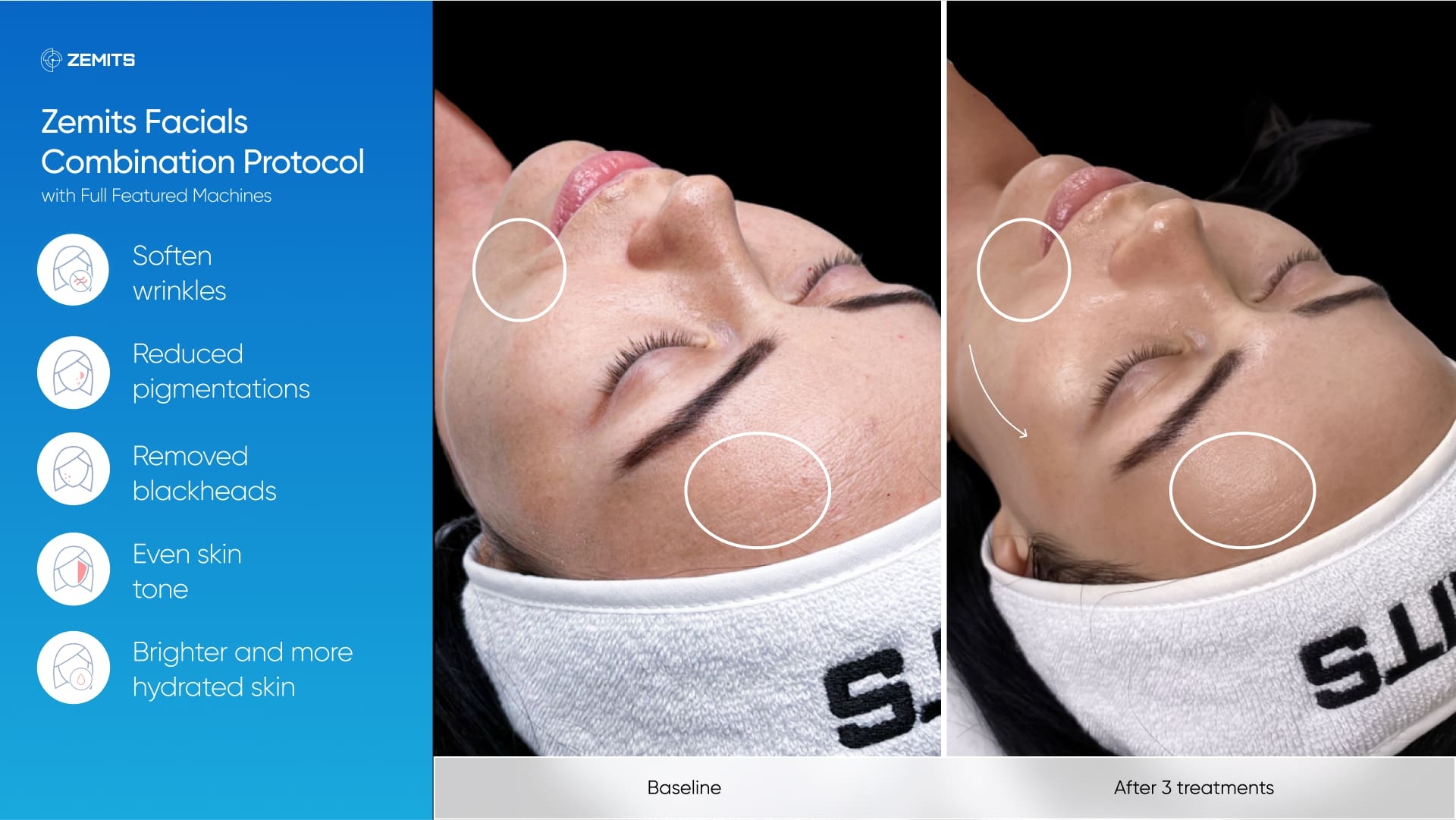 Zemits_real_results_601.jpg My default image