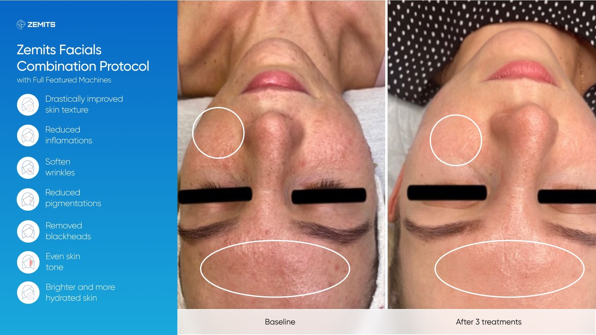 Zemits_real_results_602.jpg My default image