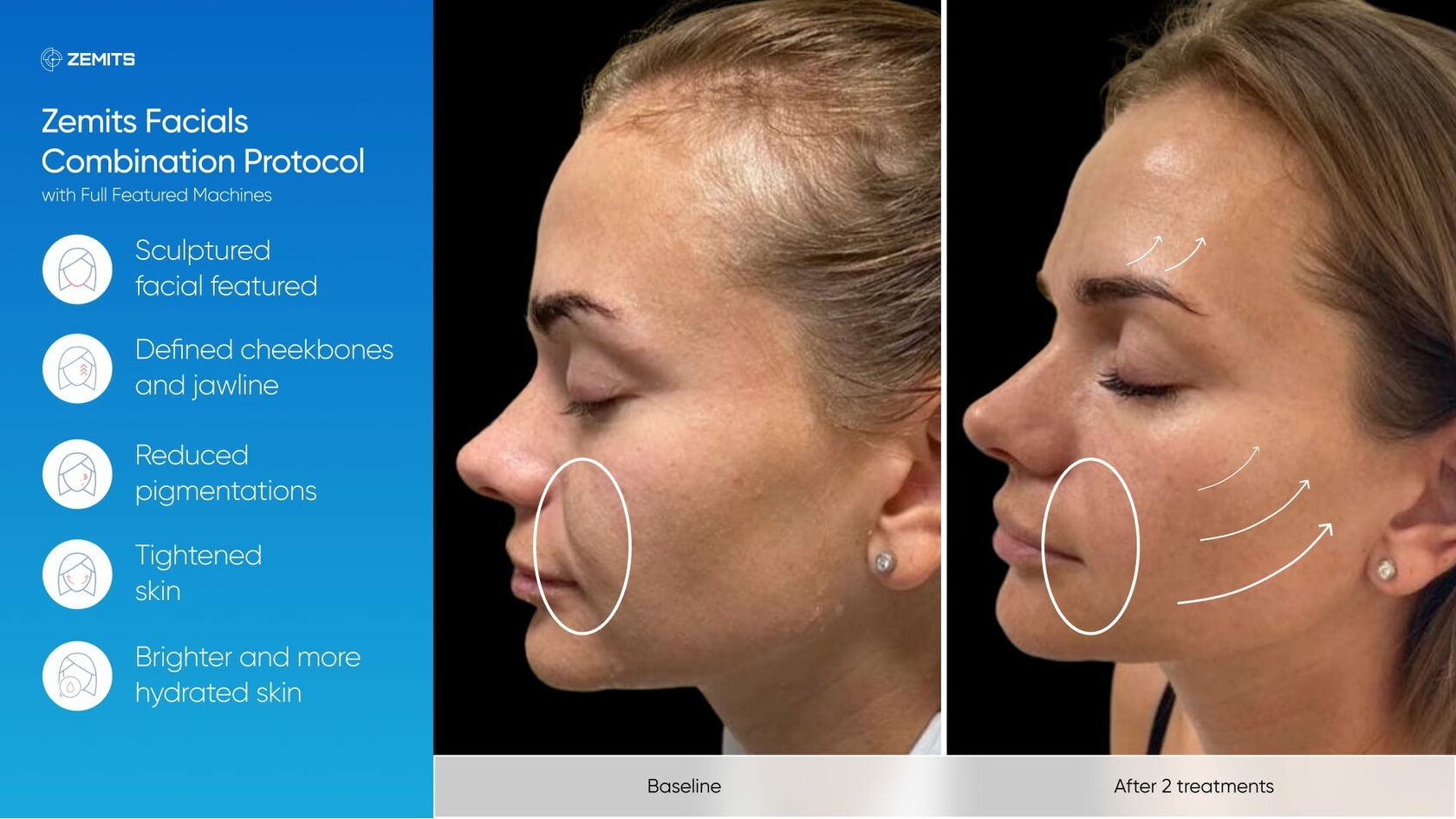 Zemits_real_results_603.jpg My default image