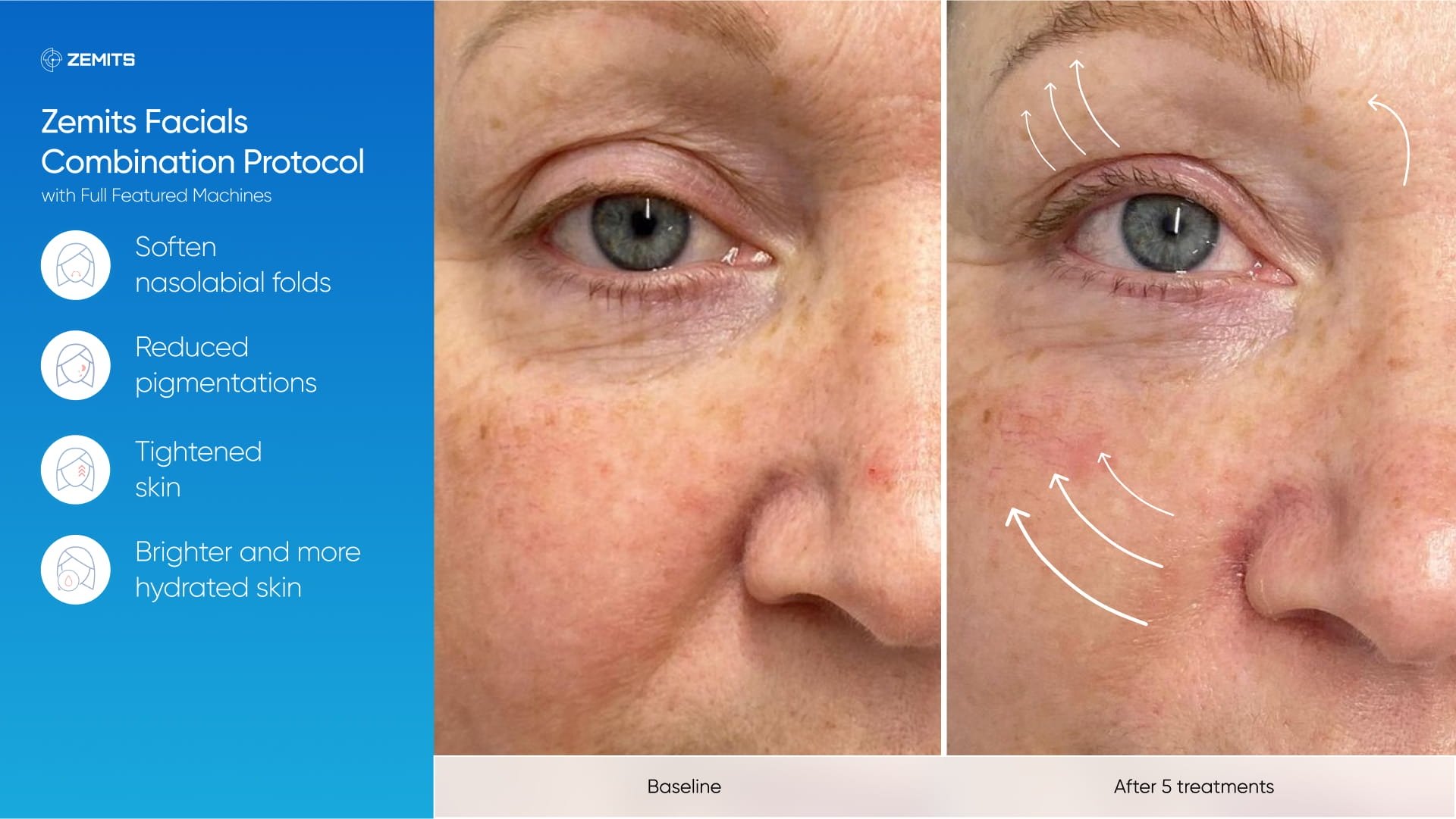 Zemits_real_results_604.jpg My default image