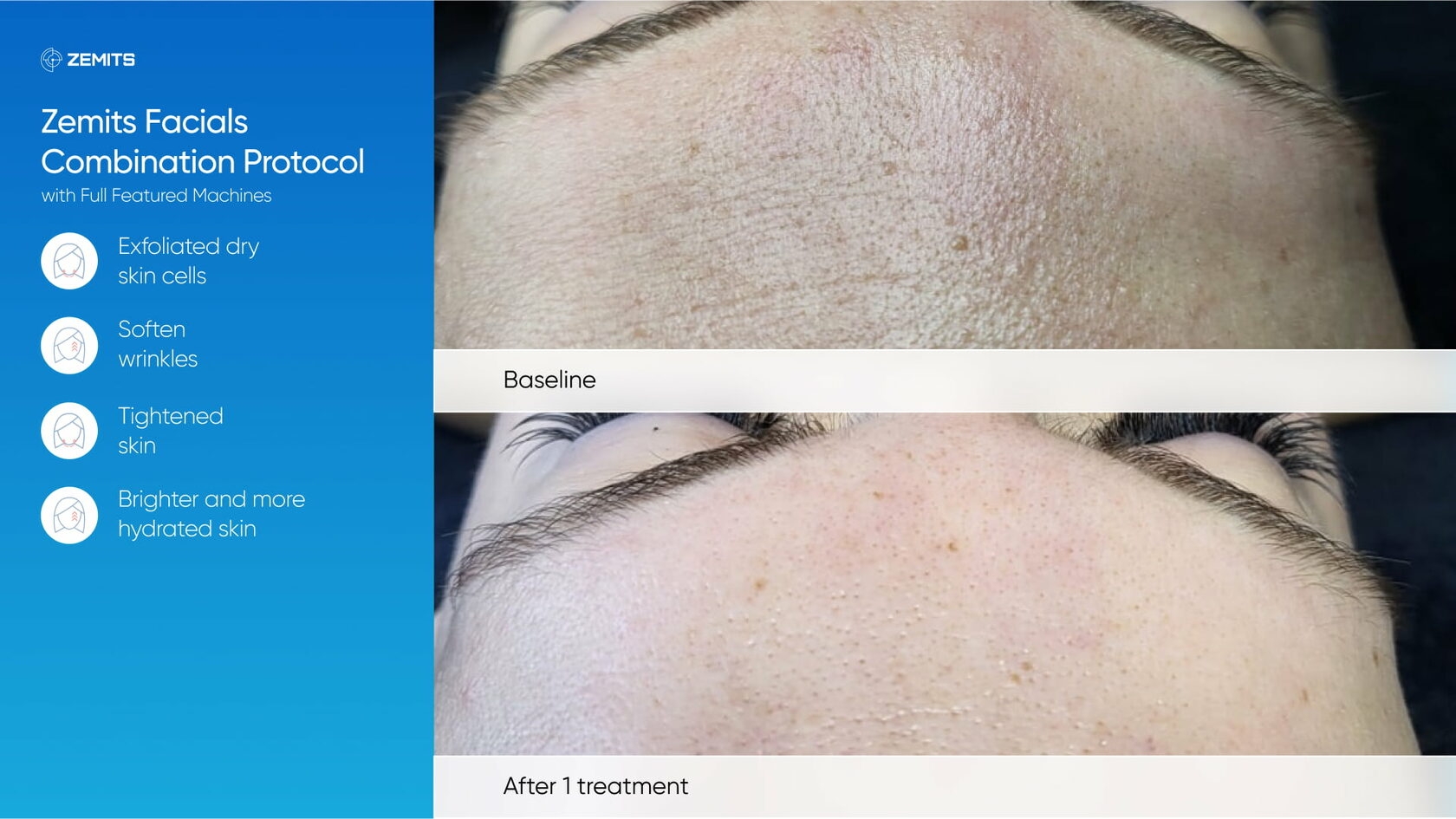 Zemits_real_results_605.jpg My default image