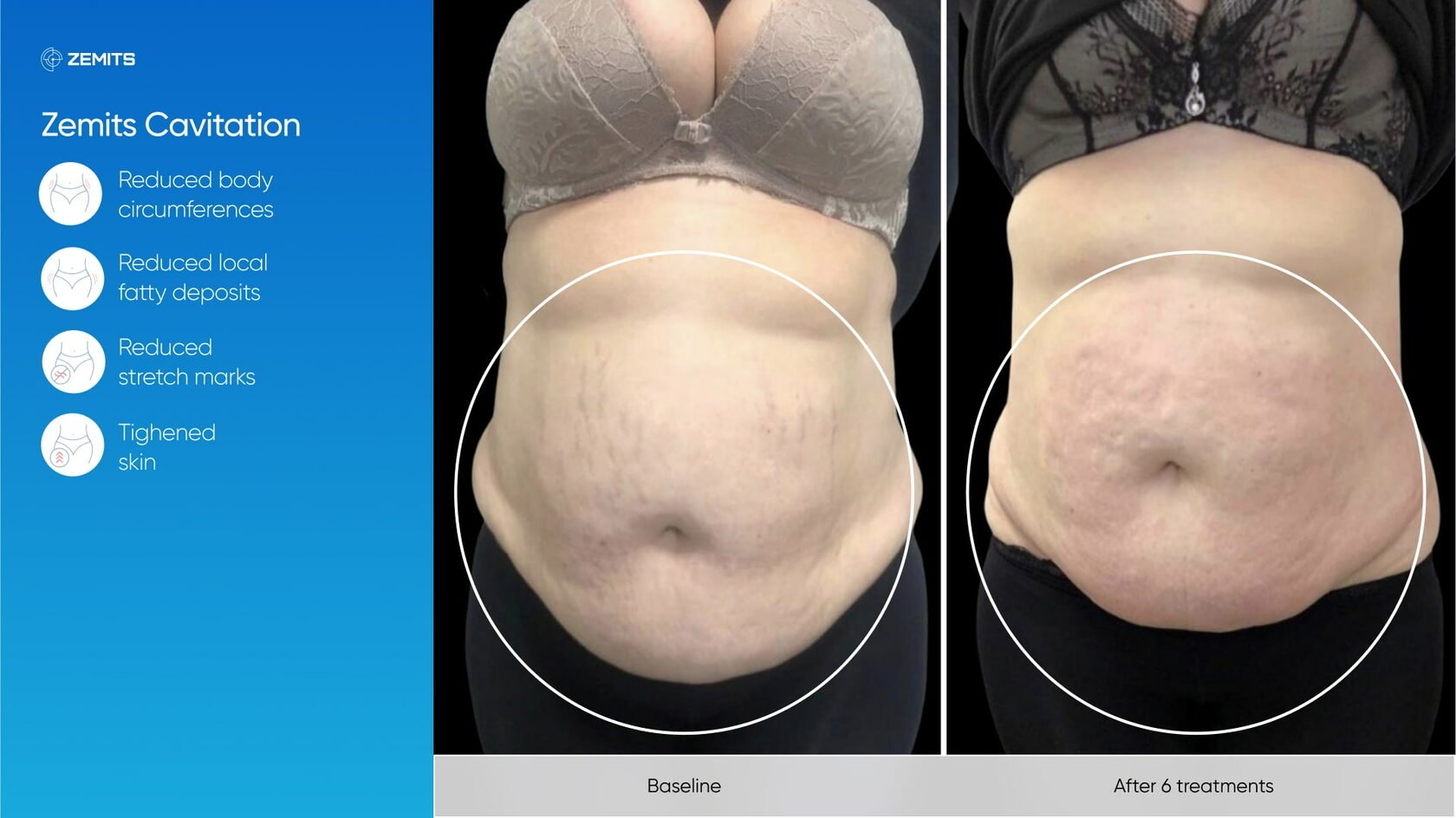 Zemits_real_results_701.jpg My default image