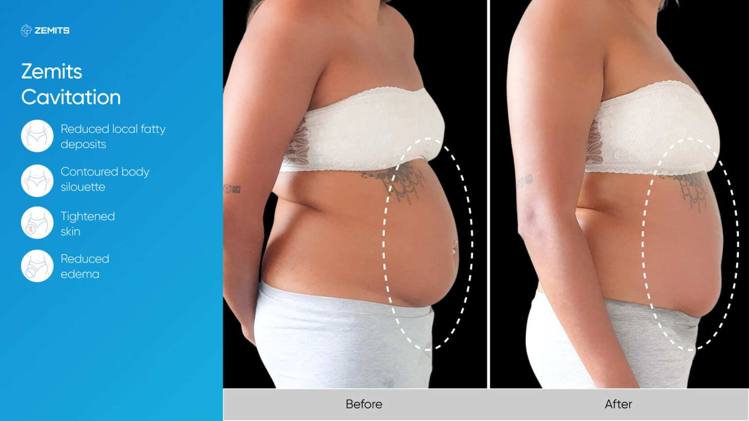 Zemits_real_results_702.jpg My default image