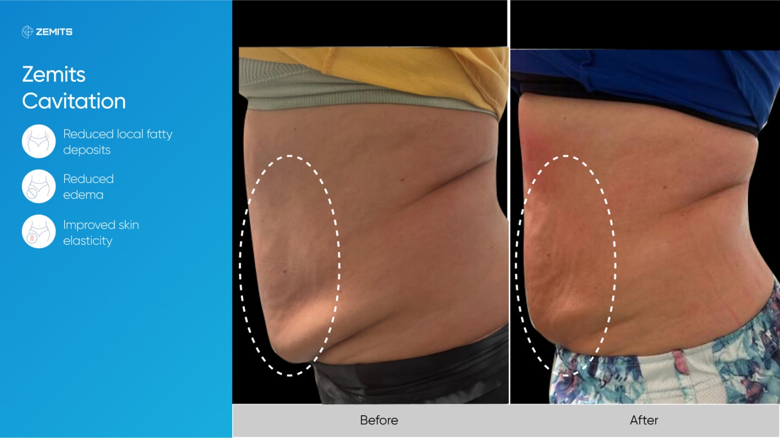 Zemits_real_results_703.jpg My default image