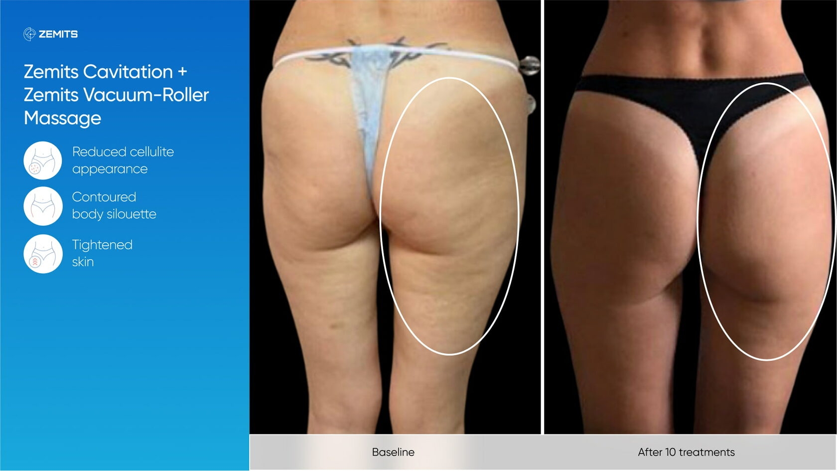 Zemits_real_results_801.jpg My default image