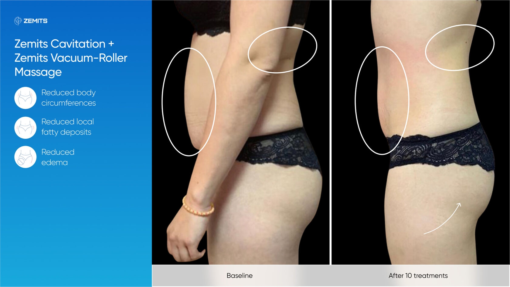 Zemits_real_results_802.jpg My default image