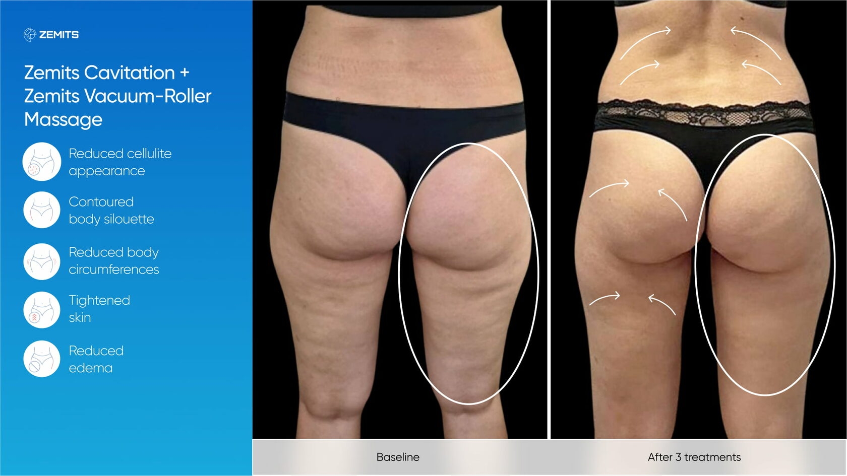 Zemits_real_results_803.jpg My default image