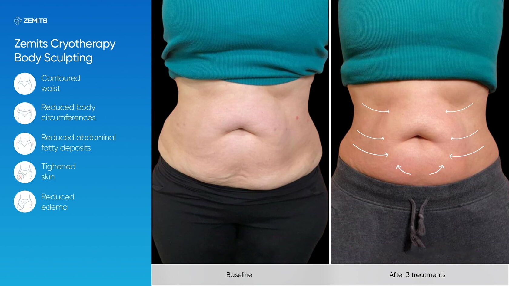 Zemits_real_results_901.jpg My default image