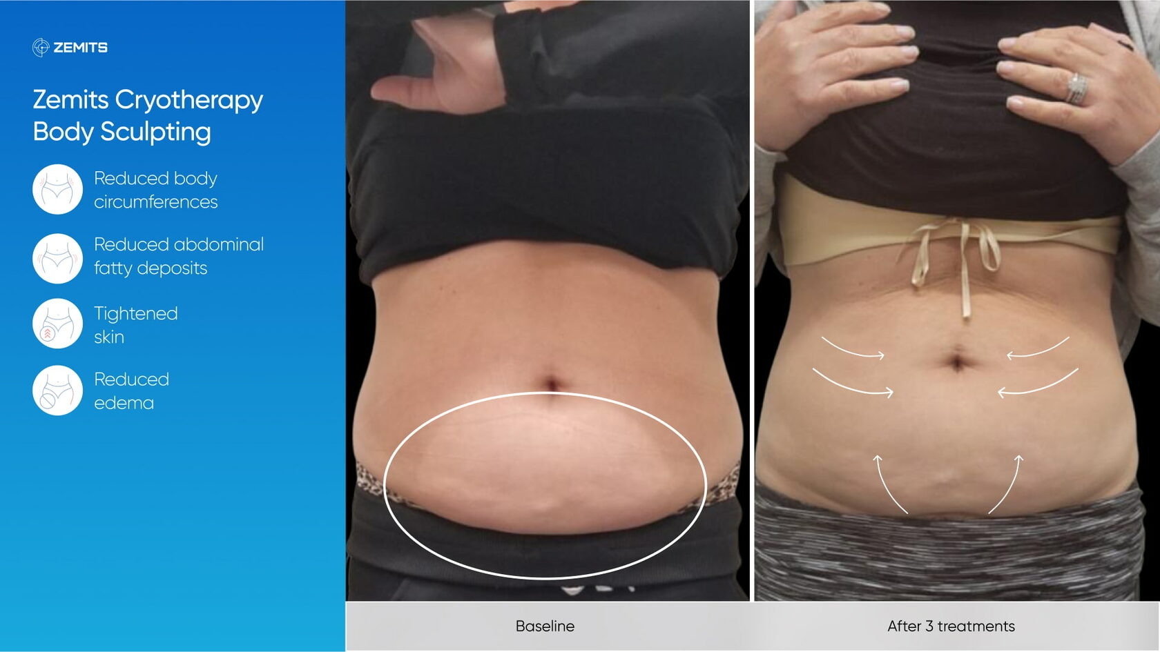 Zemits_real_results_902.jpg My default image