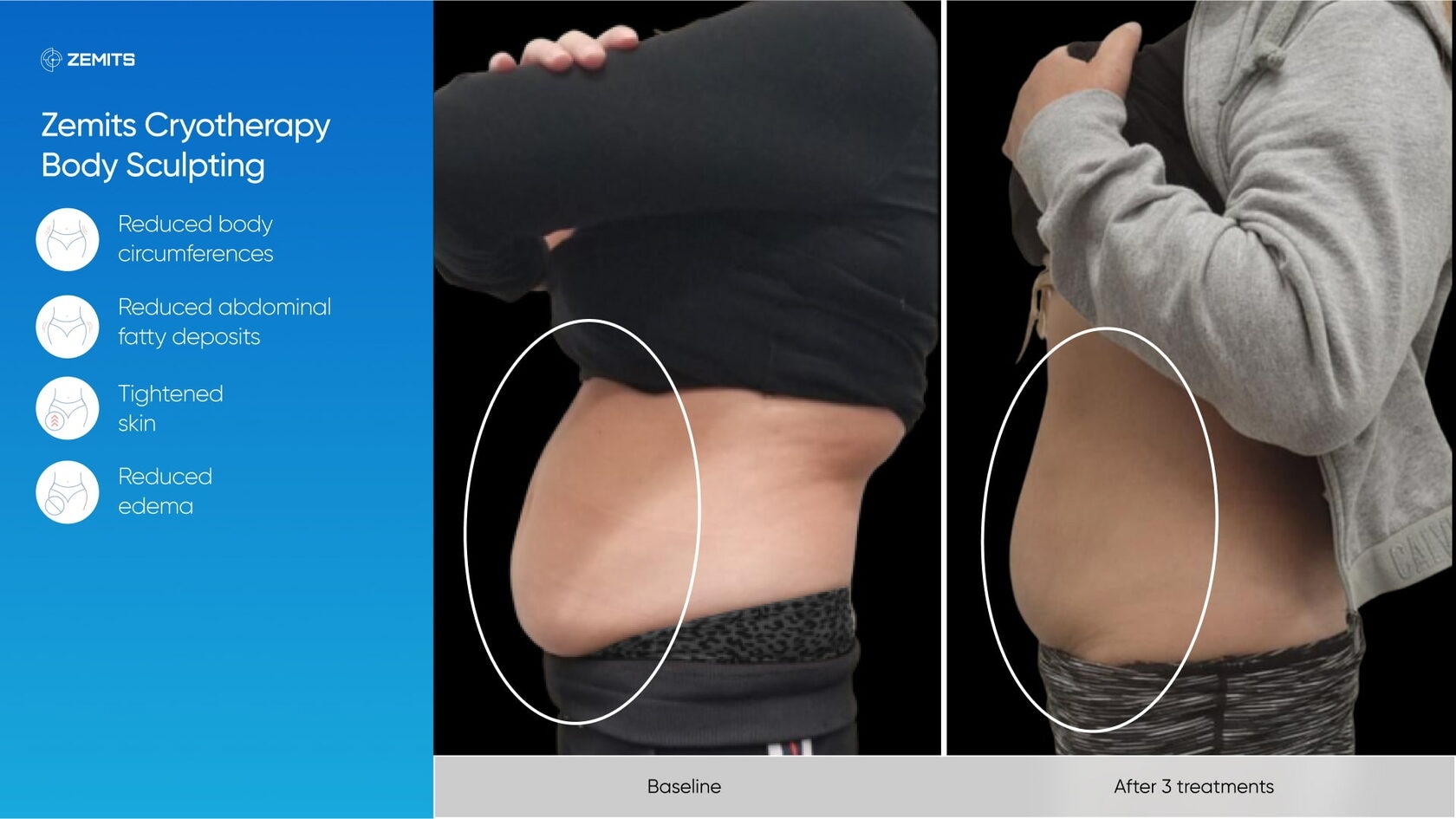 Zemits_real_results_903.jpg My default image