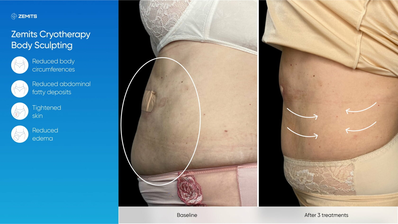 Zemits_real_results_904.jpg My default image