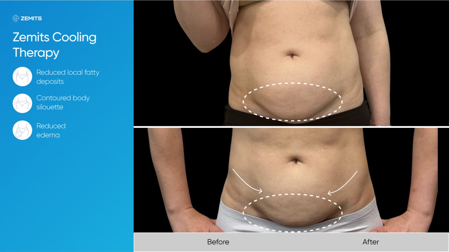 Zemits_real_results_905.jpg My default image