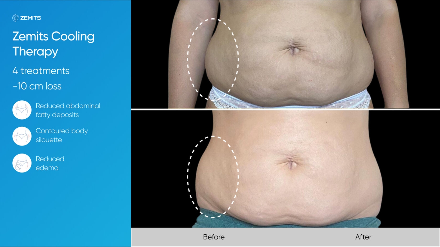 Zemits_real_results_906.jpg My default image