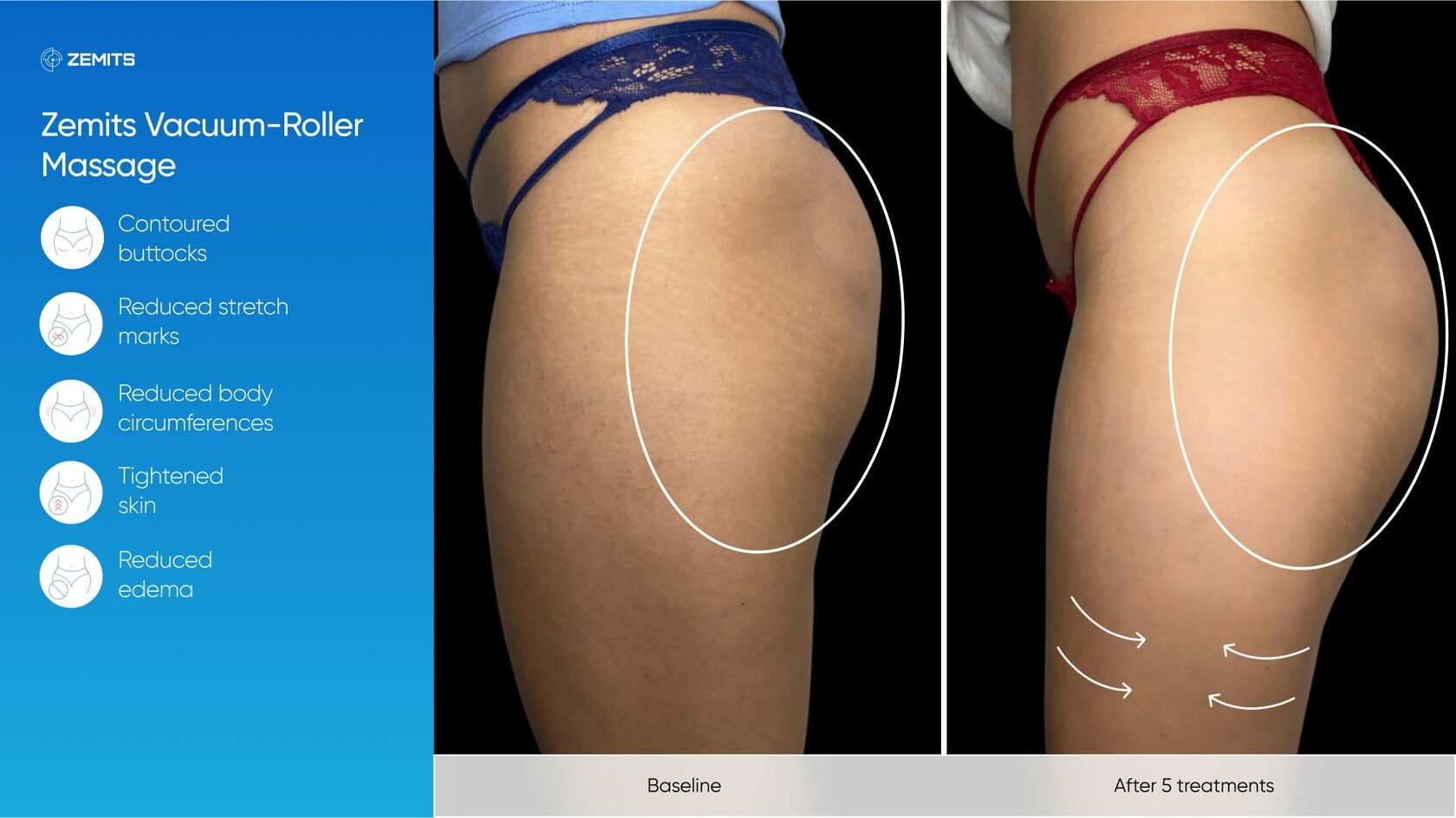 Zemits_real_results_1001.jpg My default image