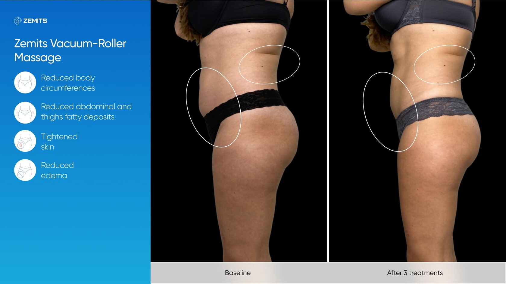 Zemits_real_results_1002.jpg My default image