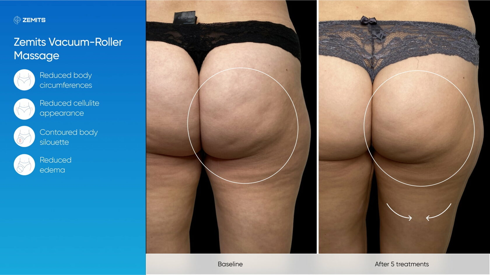 Zemits_real_results_1003.jpg My default image