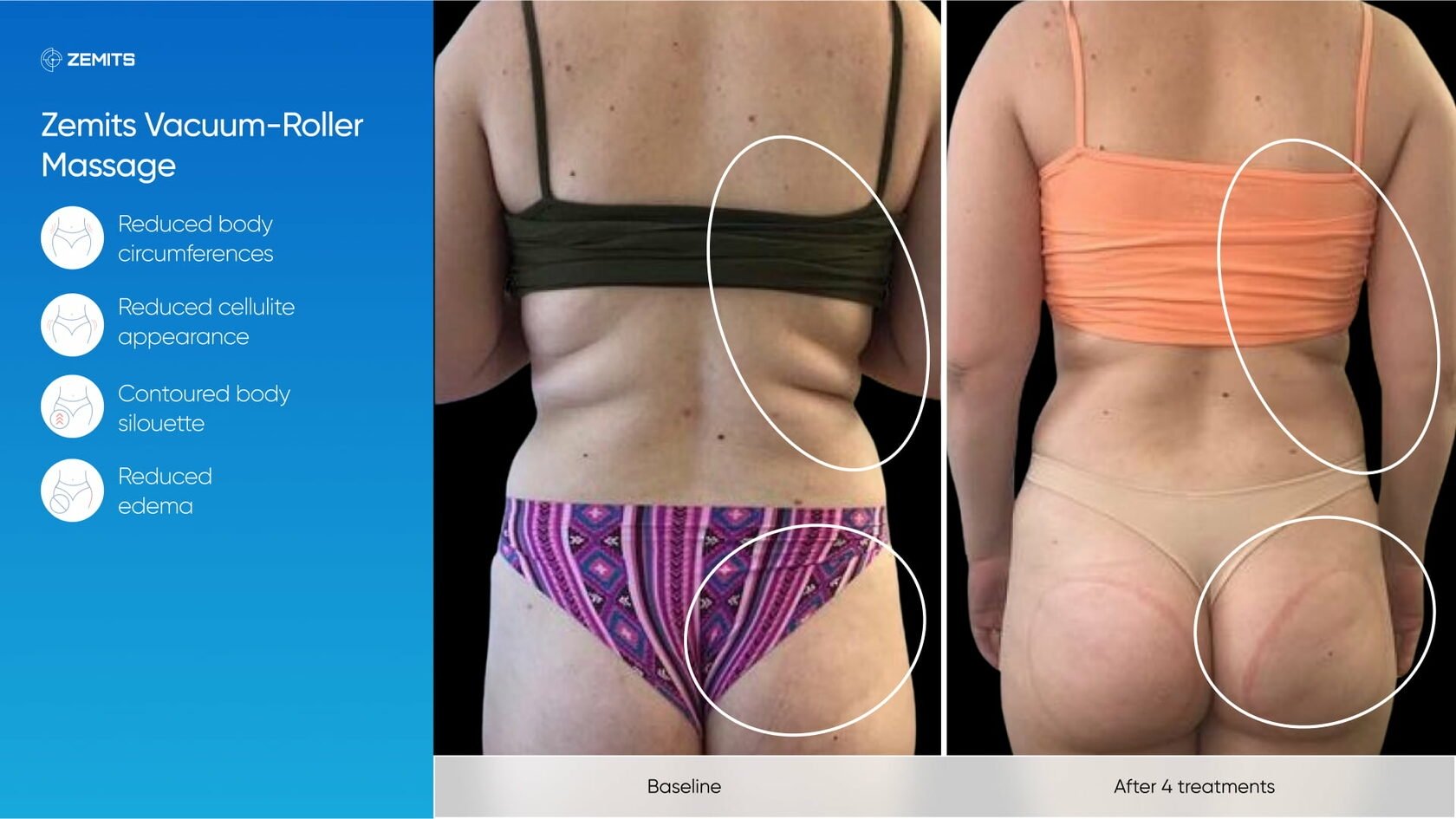 Zemits_real_results_1004.jpg My default image