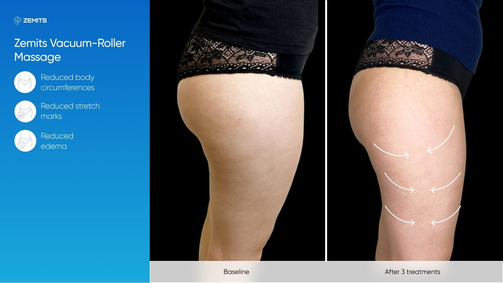 Zemits_real_results_1005.jpg My default image