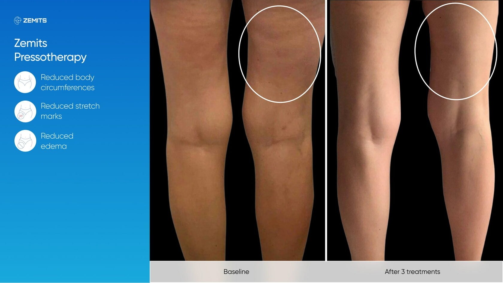 Zemits_real_results_1006.jpg My default image